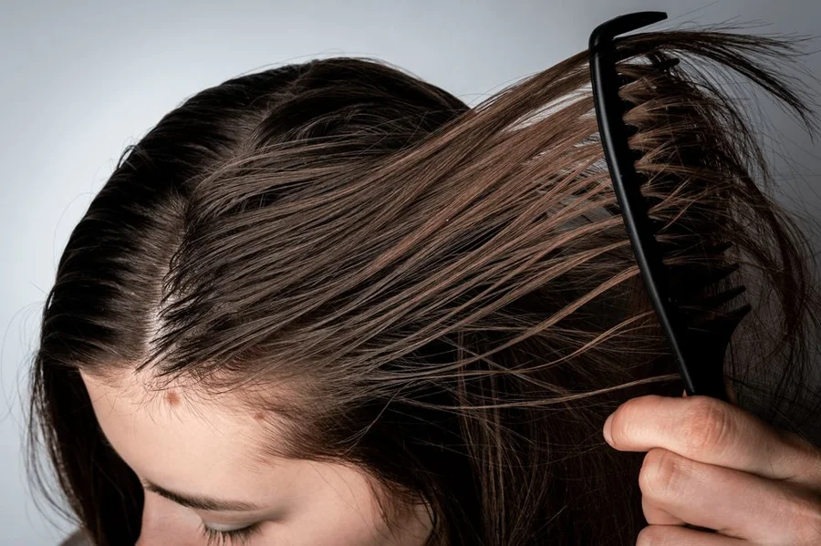 Cabello graso que se ensucia rápido y pierde volumen por exceso de sebo — Dr. Asian · Blondas Paraguay