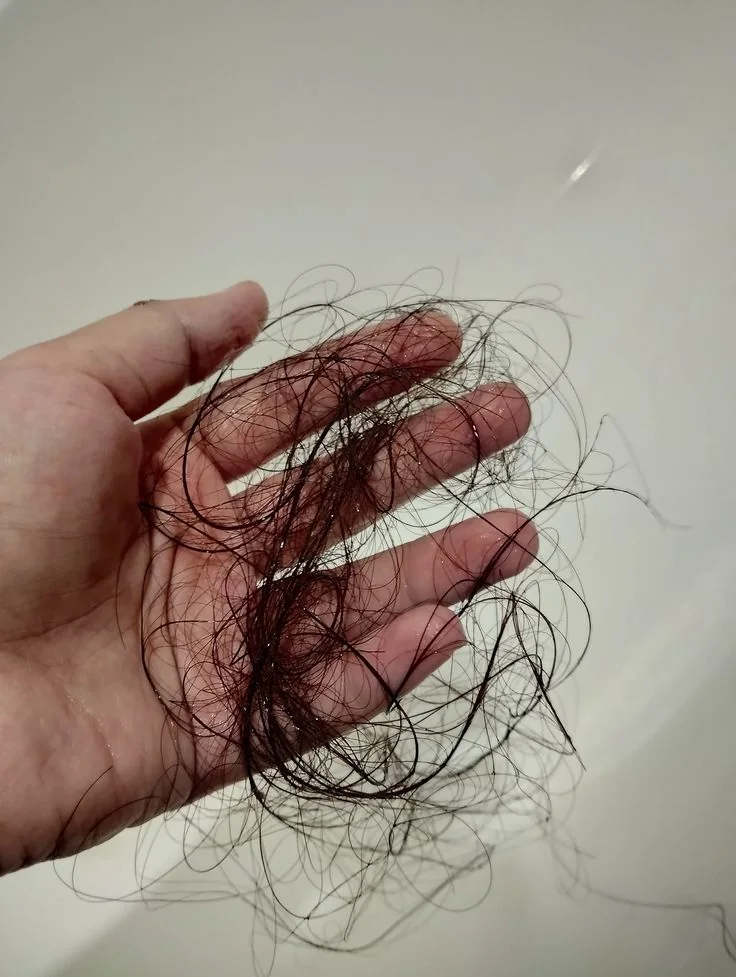 Caída de pelo por Mounjaro, Ozempic o tirzepatida — Dr. Asian · Blondas Paraguay